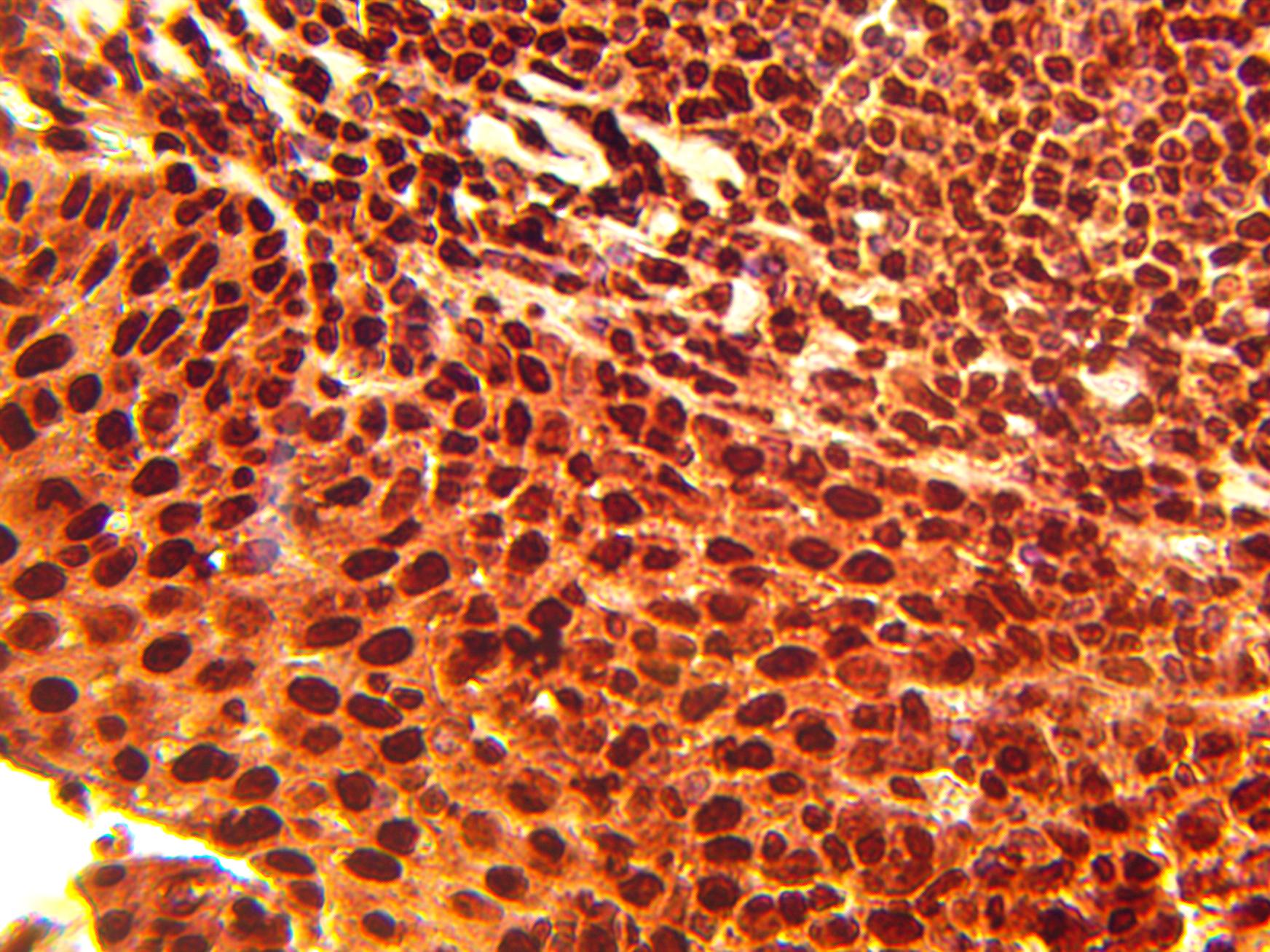 Immunohistochemical staining of normal human tonsil tissue using TOP1 antibody (Cat. No. X2732P) at 10 µg/ml and detected using anti-Rabbit HRP secondary antibody and visualized using DAB substrate and hematoxylin counterstain.